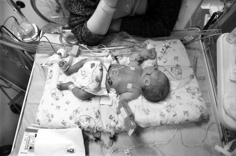 Air pollution linked to premature births