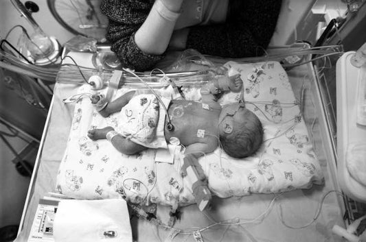 Air pollution linked to premature births