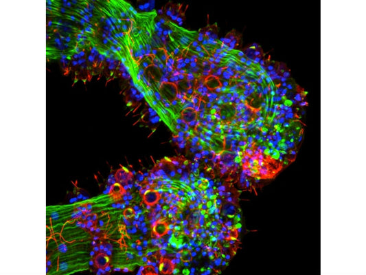 Stinging Cells in Eyeless Hydra React to Light