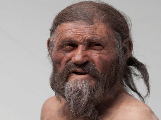 Health Check for Oetzi the Iceman